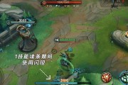 《LOL手游》EZ攻略（无敌的EZ，如何在游戏中发挥最大价值？）