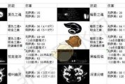 DNF男圣骑士技能攻略（全面解析男圣骑士技能，助你成为顶尖圣骑士！）